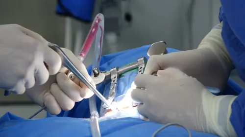 Chirurgia epatica nel Pontino, la Asl Latina: nella sanità pubblica competenze e tecnologie già consolidate