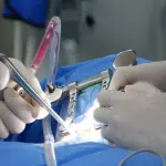 Chirurgia epatica nel Pontino, la Asl Latina: nella sanità pubblica competenze e tecnologie già consolidate