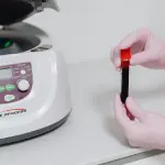 Latina leader nel Lazio per la raccolta di plasma: confermata l’apertura pomeridiana al Goretti